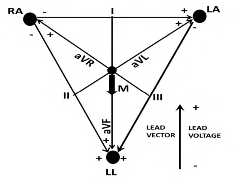 Diagram for GATE 2022 BM question 43